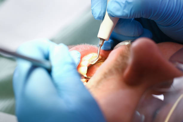 Best Emergency Denture Repair in Shamrock, TX