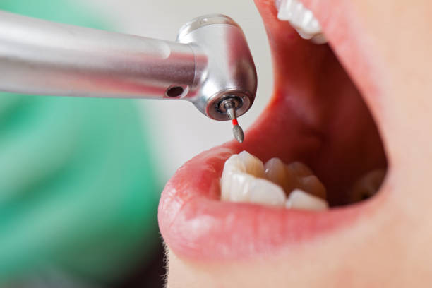 Best Emergency Treatment for Oral Infections in Shamrock, TX